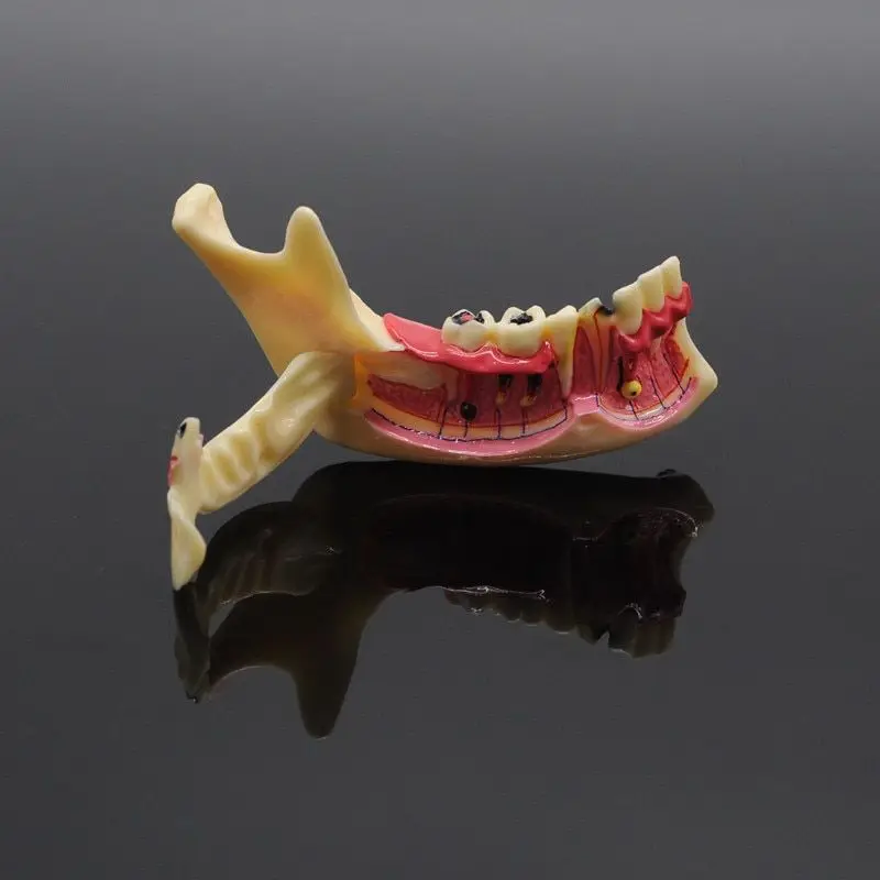 Модель зубов Модель эндодонтического лечения зубов Анатомия десен Модель обучения стоматологическому исследованию